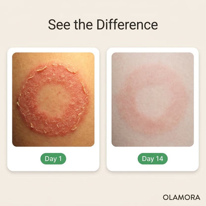 OLAMORA Antifungal Tea Tree Bar